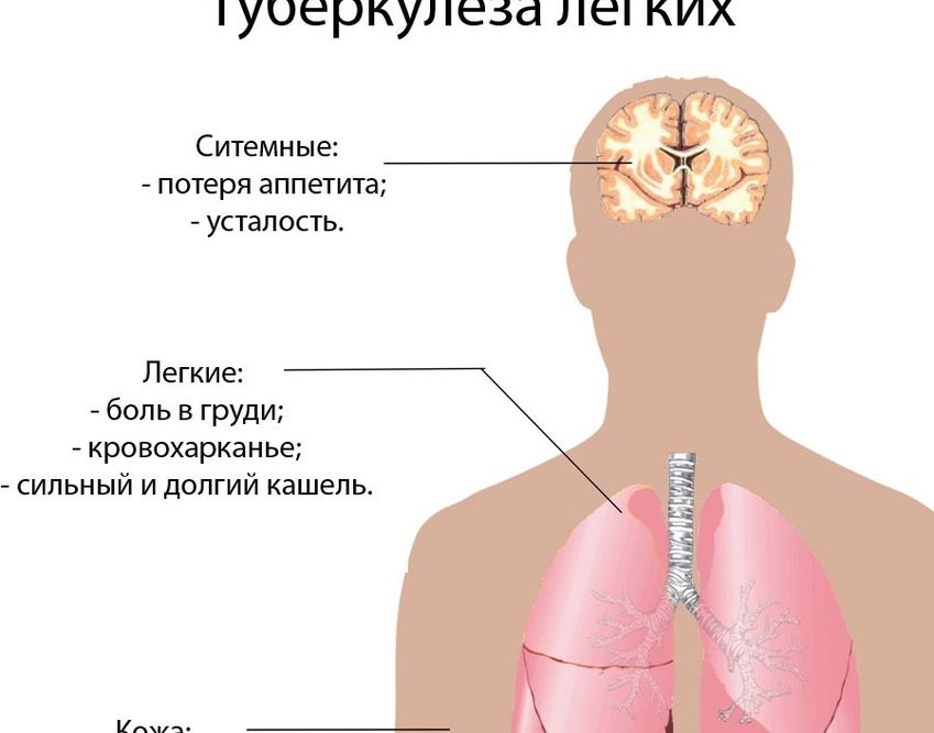 8e3b79a076fad90e56b1dcadebc824828b3ae03e9cb999d3176553cb332da7c63